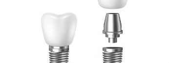 dental-crown