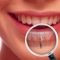 روش جدید التیام زخمهای دهانی