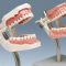 پروتز دندانی | پروتز های دندانی چگونه ساخته می شود؟