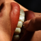 فیلم تفاوت کامپوزیت با لمینیت دندان