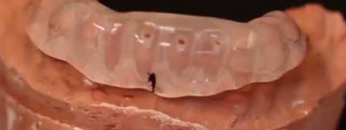dental