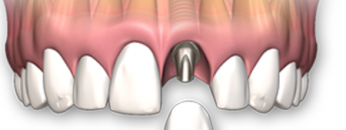 dental1