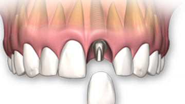 dental1