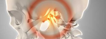 اختلالات مفصل فکی و گیجگاهی