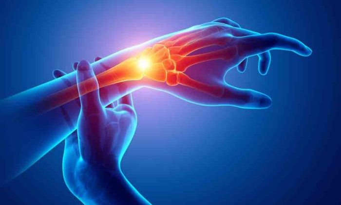 wrist-pain