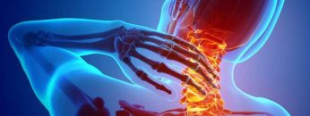 Neck-Pain