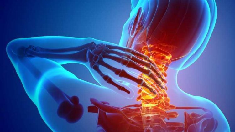 Neck-Pain