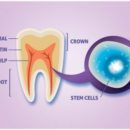 کاشت دندان با سلول های بنیادی