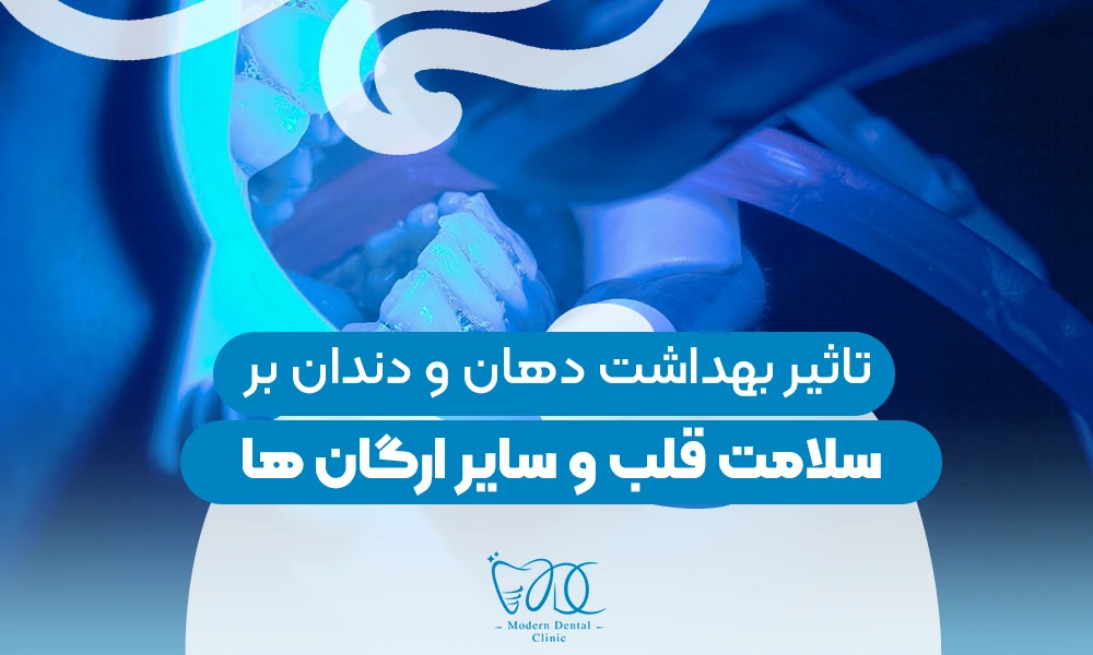 تصویر پیش بار گذاری