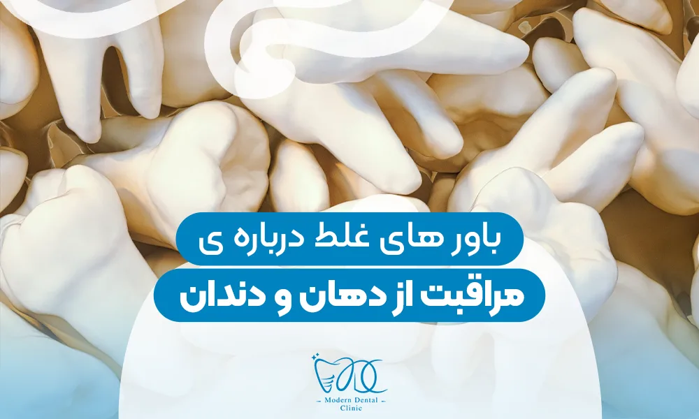 تصویر پیش بار گذاری