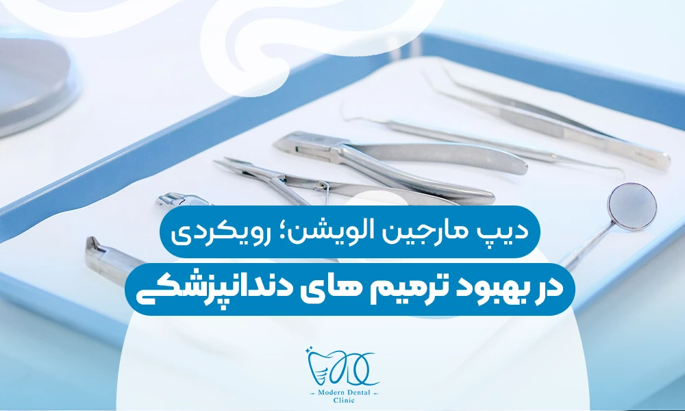 تصویر پیش بار گذاری