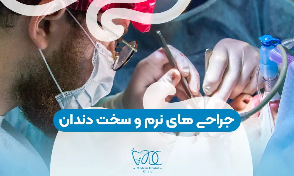 تصویر پیش بار گذاری
