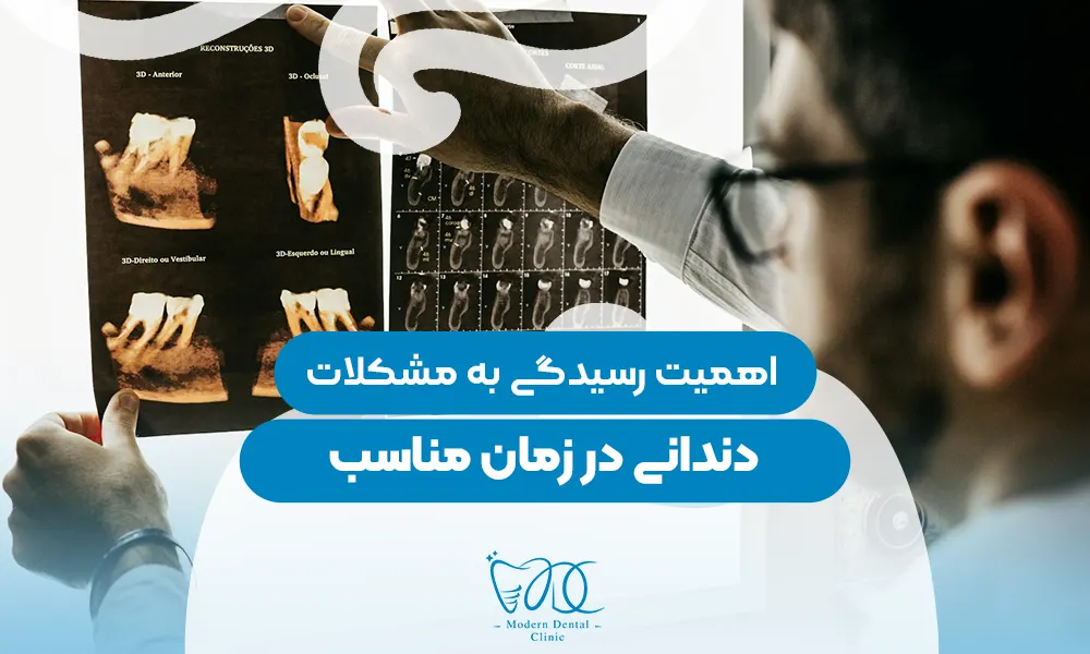 تصویر پیش بار گذاری