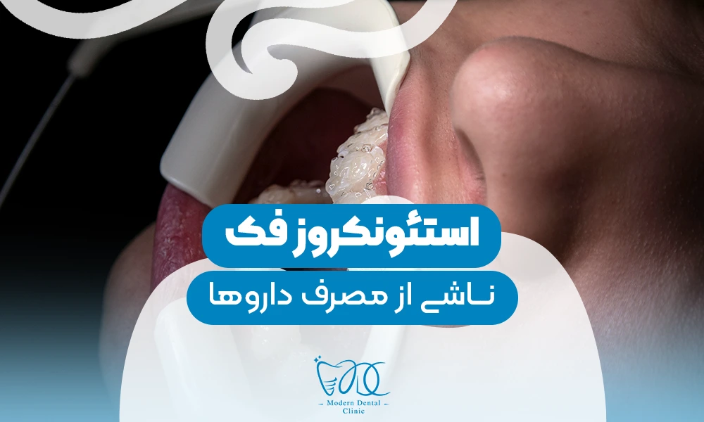 تصویر پیش بار گذاری