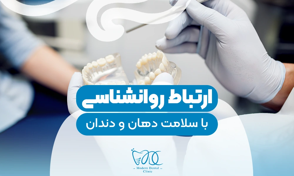 تصویر پیش بار گذاری