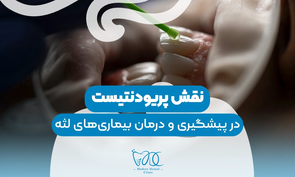 تصویر پیش بار گذاری