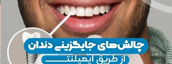 challenges-of-tooth-replacement-via-implants 1