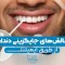 challenges-of-tooth-replacement-via-implants 1