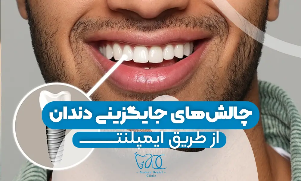 تصویر پیش بار گذاری