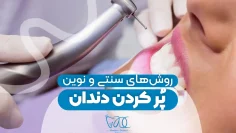 examining-modern-and-traditional-methods-of-filling-teeth 1