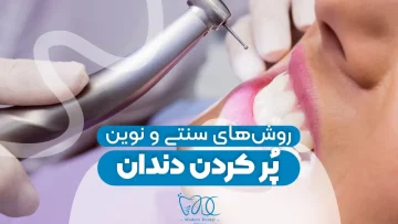 examining-modern-and-traditional-methods-of-filling-teeth 1