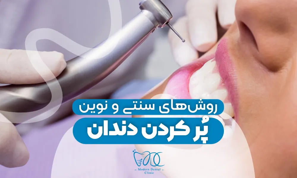 تصویر پیش بار گذاری