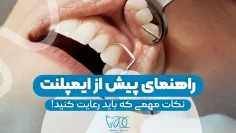 pre-dental-implant-guide 1