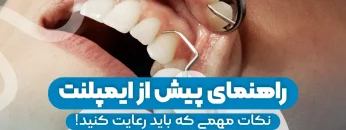 pre-dental-implant-guide 1