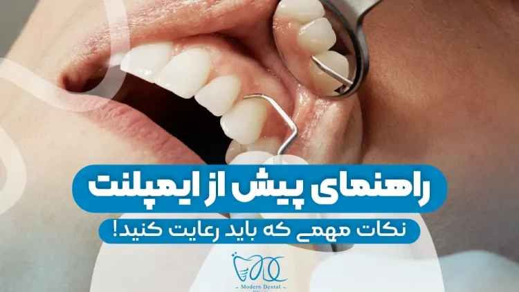 pre-dental-implant-guide 1