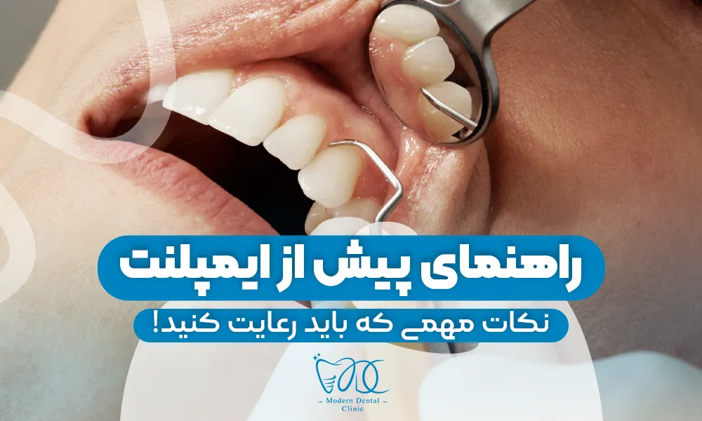 تصویر پیش بار گذاری