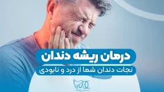 root-canal-treatment 1