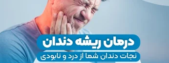 root-canal-treatment 1