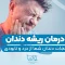 root-canal-treatment 1