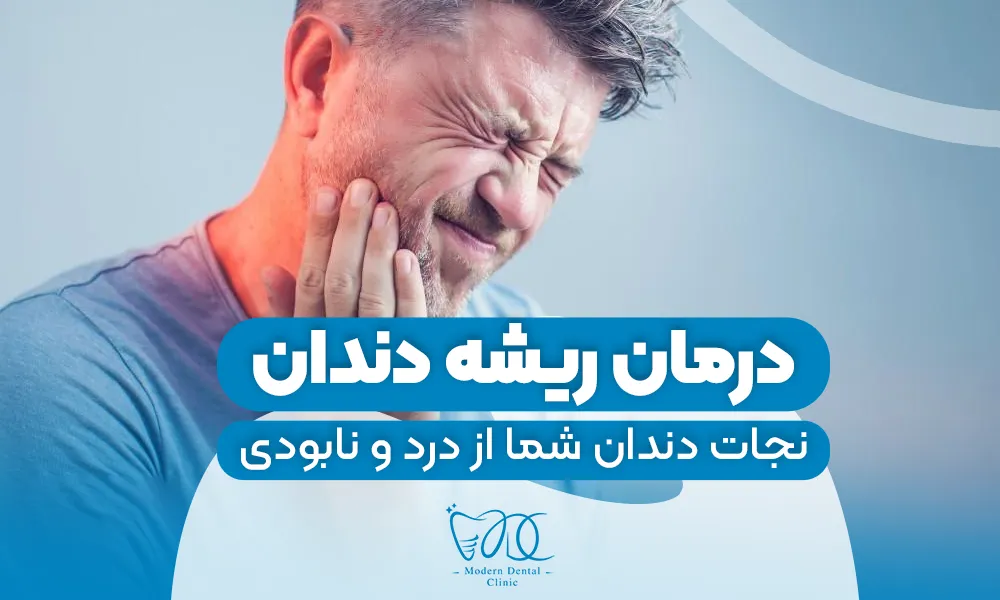 تصویر پیش بار گذاری