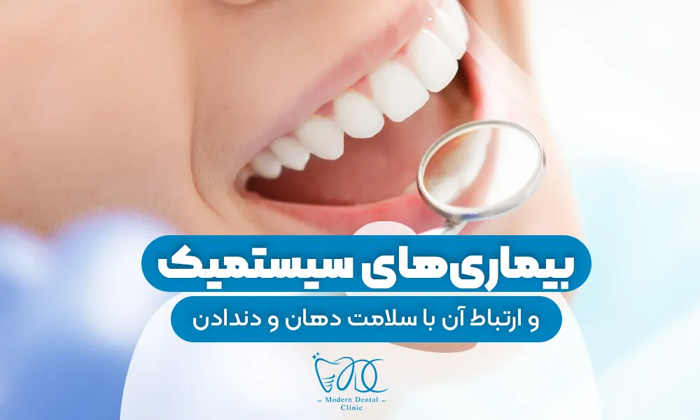 تصویر پیش بار گذاری