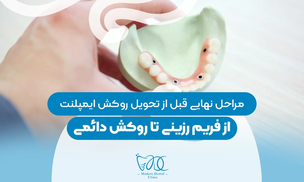 تصویر پیش بار گذاری