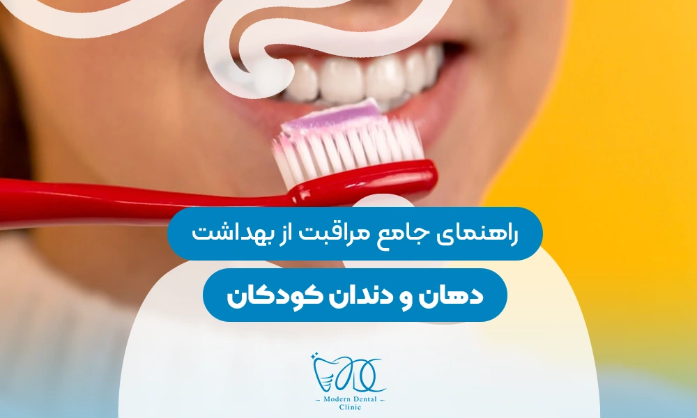 تصویر پیش بار گذاری