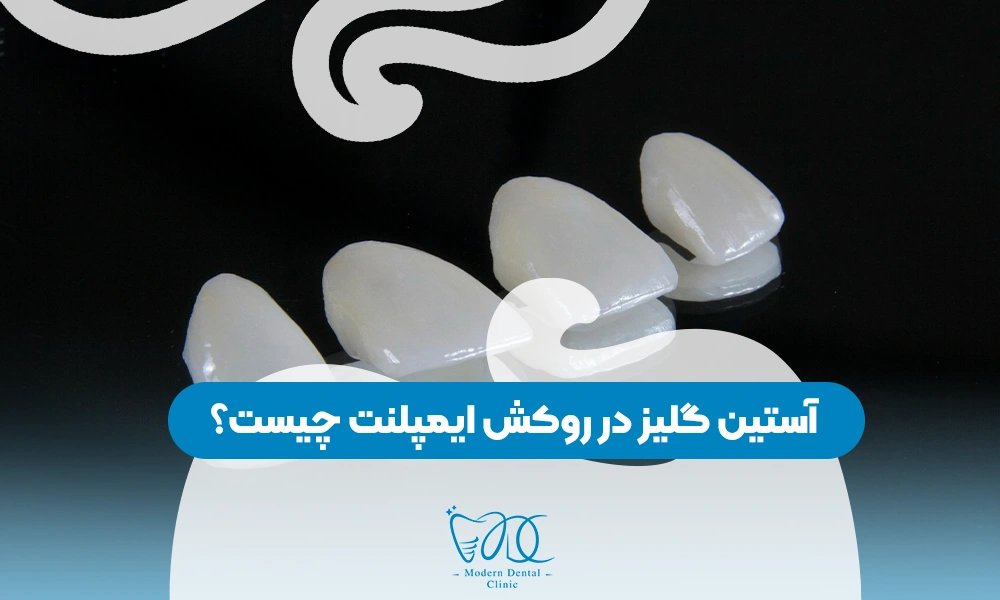 تصویر پیش بار گذاری