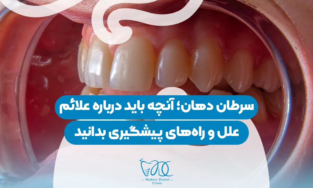 تصویر پیش بار گذاری