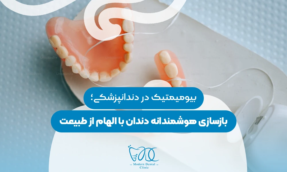 تصویر پیش بار گذاری