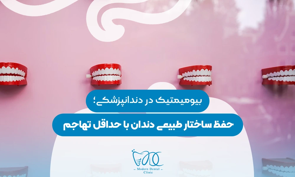 تصویر پیش بار گذاری