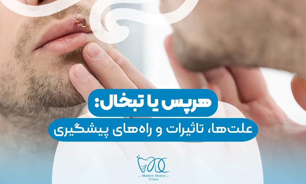 تصویر پیش بار گذاری