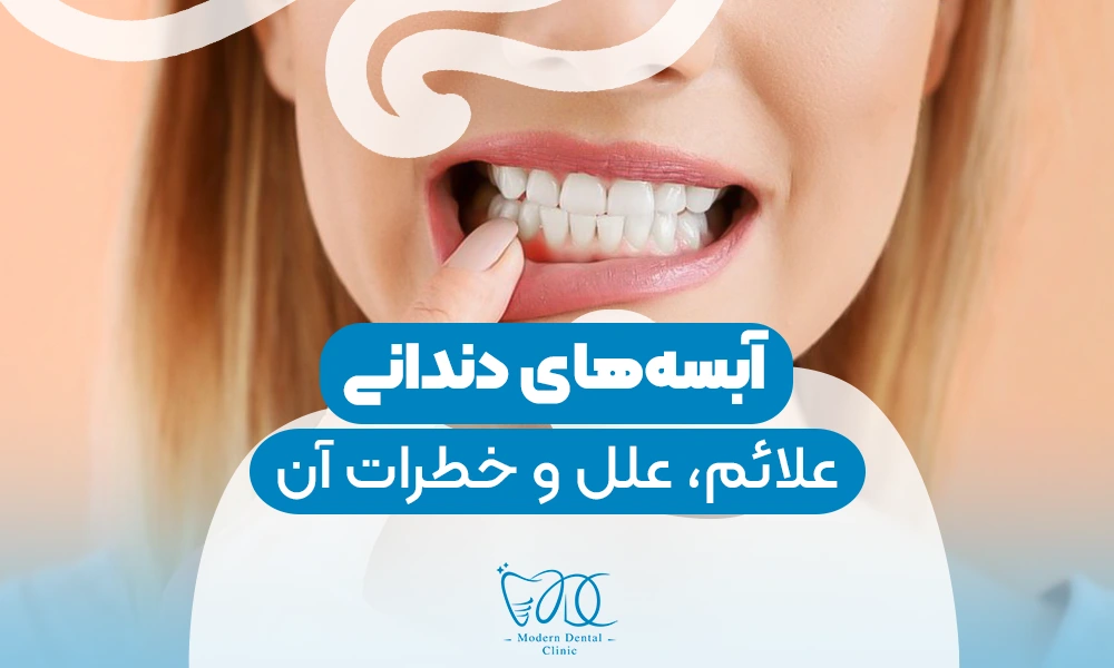 تصویر پیش بار گذاری