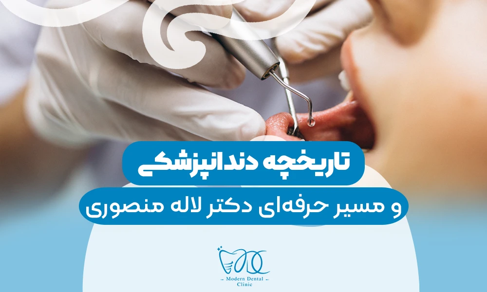 تصویر پیش بار گذاری