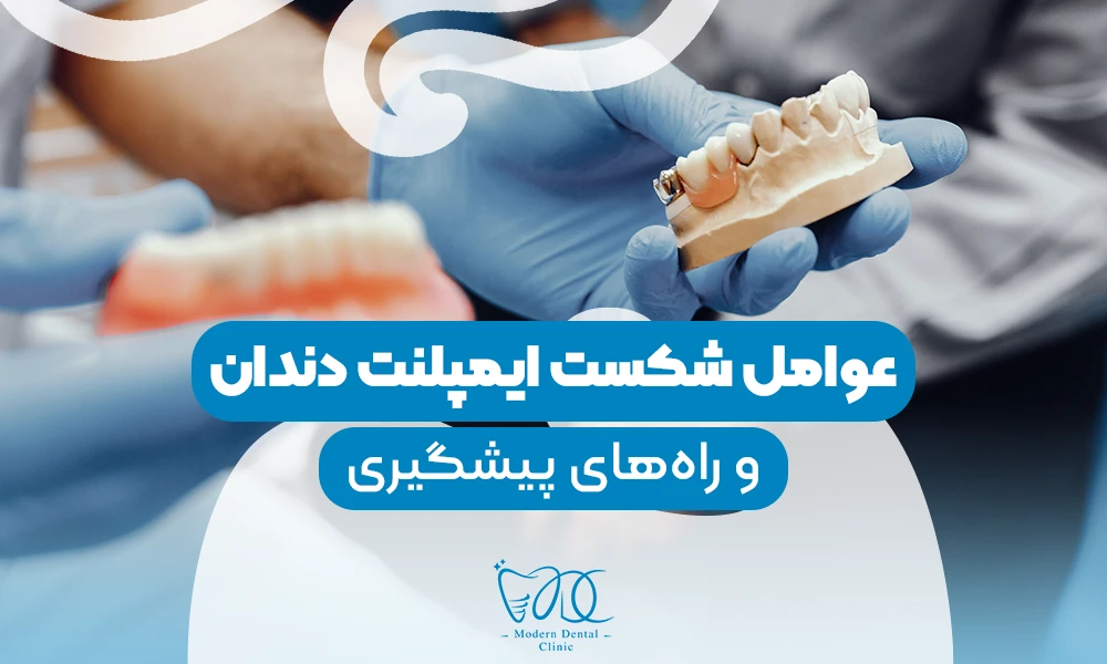 تصویر پیش بار گذاری