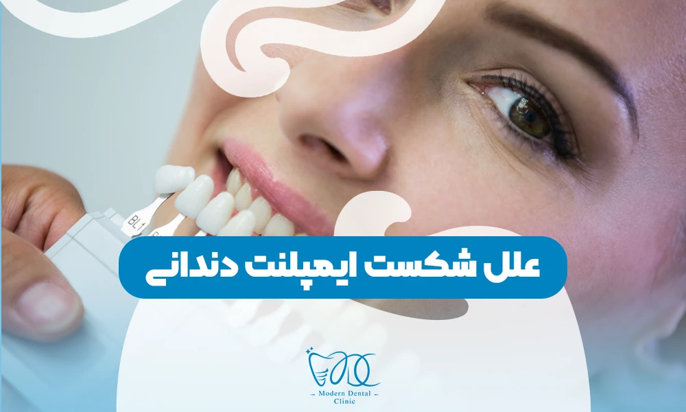تصویر پیش بار گذاری
