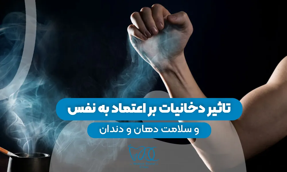 تصویر پیش بار گذاری
