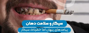 S24- تاثیر سیگار بر دندان (پارت دو) – دکتر حافظی 1