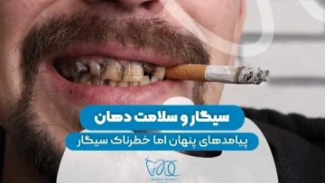 S24- تاثیر سیگار بر دندان (پارت دو) – دکتر حافظی 1