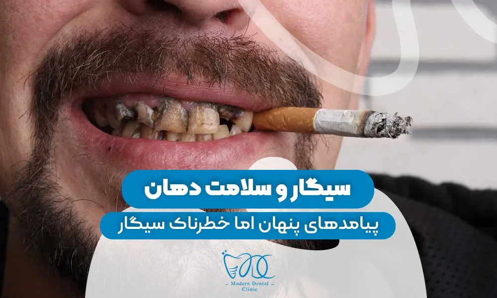 تصویر پیش بار گذاری